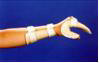 手休息支架 Hand resting splint 