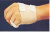 掌骨支架 – 掌骨底部骨折 Metacarpal brace – Base fracture